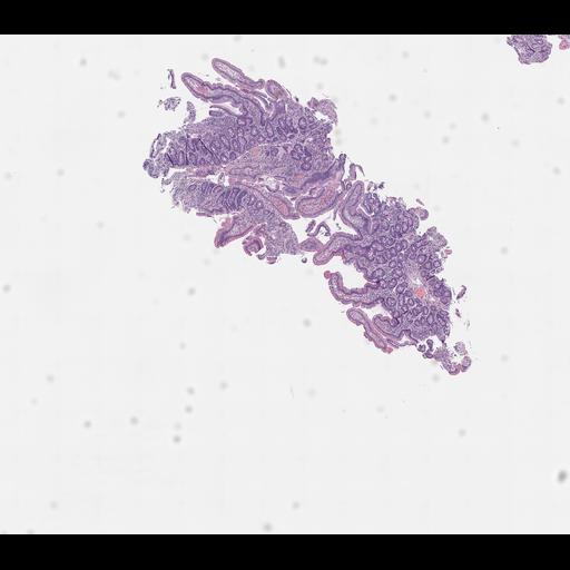  NCBI Organism:Homo sapiens, ; Biological process:;