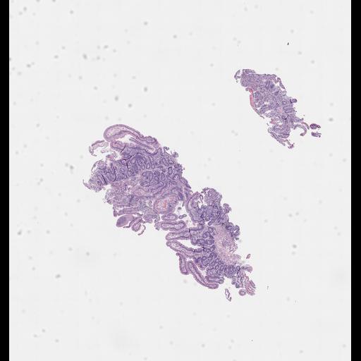  NCBI Organism:Homo sapiens, ; Biological process:;