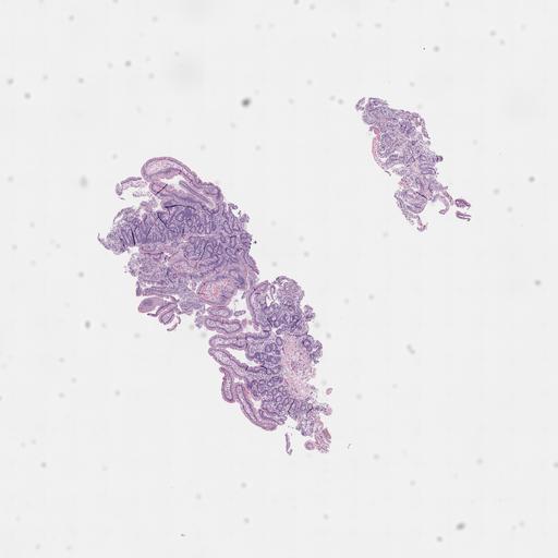  NCBI Organism:Homo sapiens, ; Biological process:;