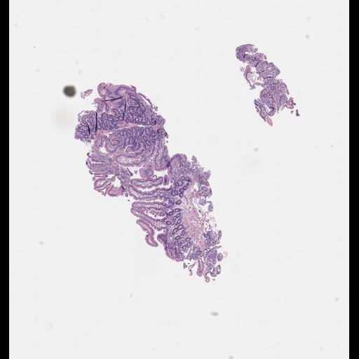  NCBI Organism:Homo sapiens, ; Biological process:;