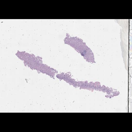  NCBI Organism:Homo sapiens, ; Biological process:;