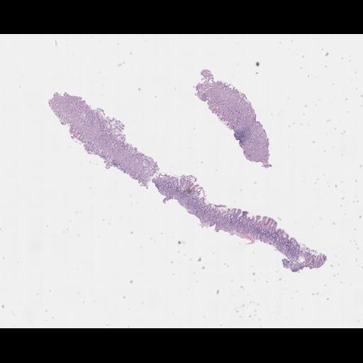  NCBI Organism:Homo sapiens, ; Biological process:;