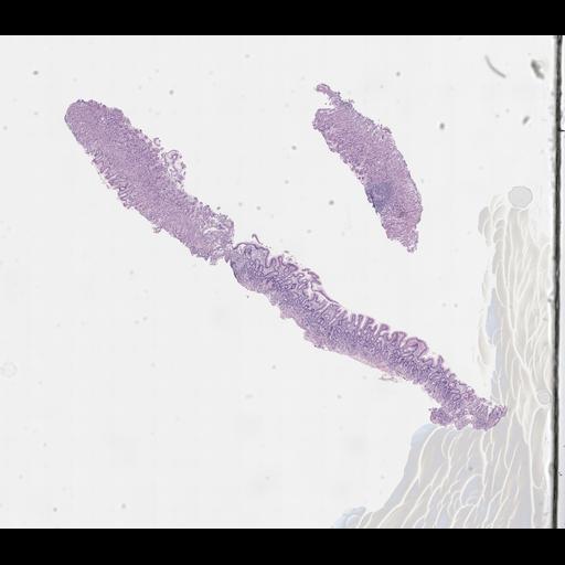  NCBI Organism:Homo sapiens, ; Biological process:;