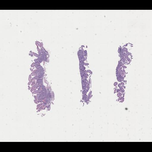  NCBI Organism:Homo sapiens, ; Biological process:;