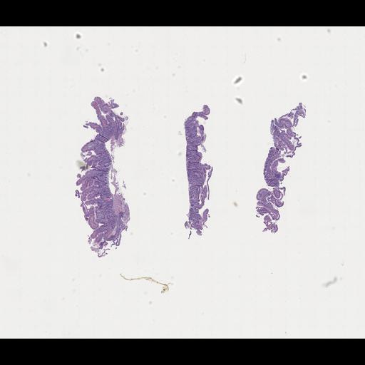  NCBI Organism:Homo sapiens, ; Biological process:;