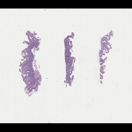  NCBI Organism:Homo sapiens, ; Biological process:;