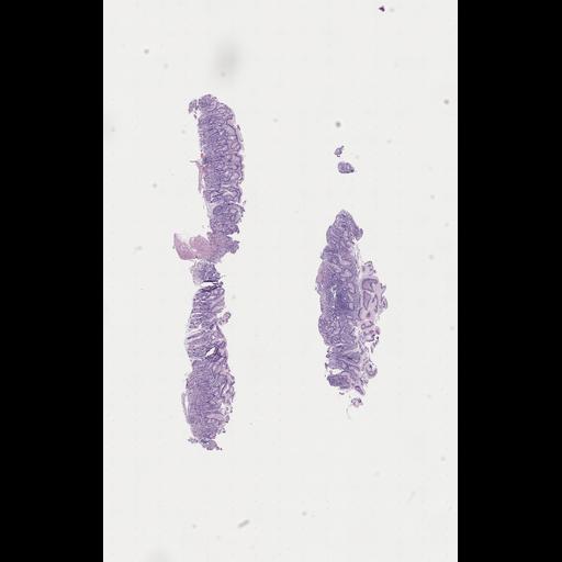  NCBI Organism:Homo sapiens, ; Biological process:;