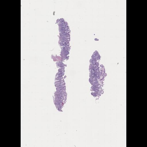  NCBI Organism:Homo sapiens, ; Biological process:;