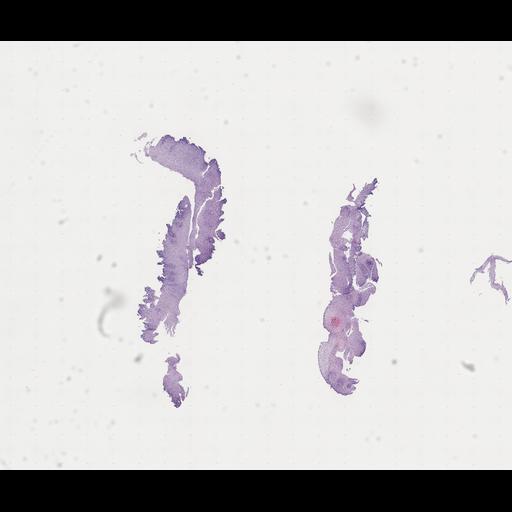  NCBI Organism:Homo sapiens, ; Biological process:;