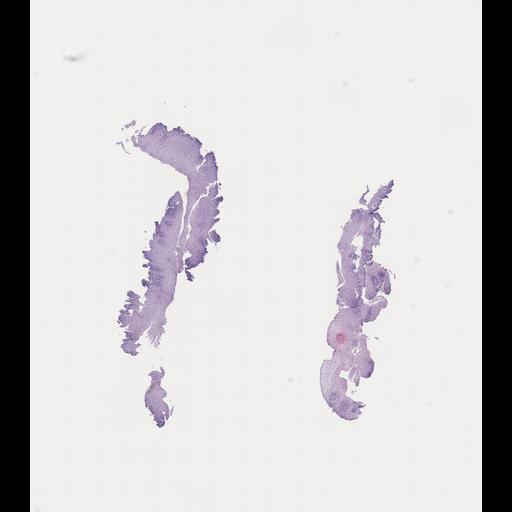  NCBI Organism:Homo sapiens, ; Biological process:;