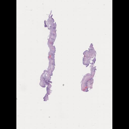  NCBI Organism:Homo sapiens, ; Biological process:;