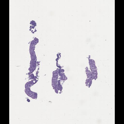  NCBI Organism:Homo sapiens, ; Biological process:;