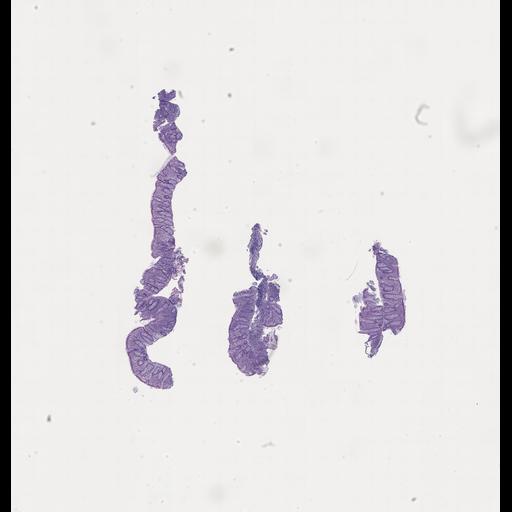  NCBI Organism:Homo sapiens, ; Biological process:;