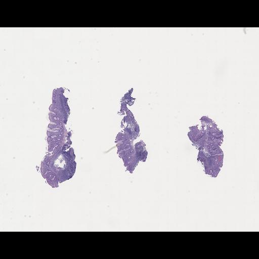  NCBI Organism:Homo sapiens, ; Biological process:;