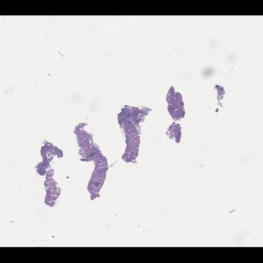  NCBI Organism:Homo sapiens, ; Biological process:;