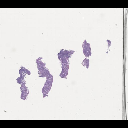  NCBI Organism:Homo sapiens, ; Biological process:;