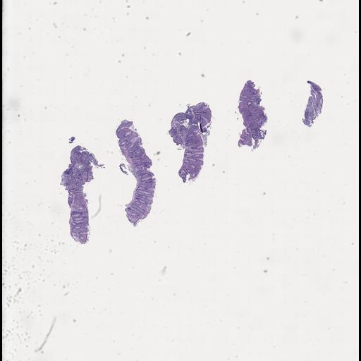  NCBI Organism:Homo sapiens, ; Biological process:;