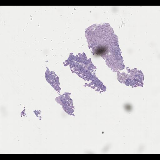  NCBI Organism:Homo sapiens, ; Biological process:;