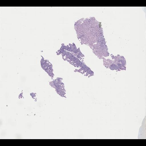  NCBI Organism:Homo sapiens, ; Biological process:;