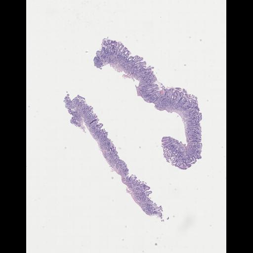  NCBI Organism:Homo sapiens, ; Biological process:;