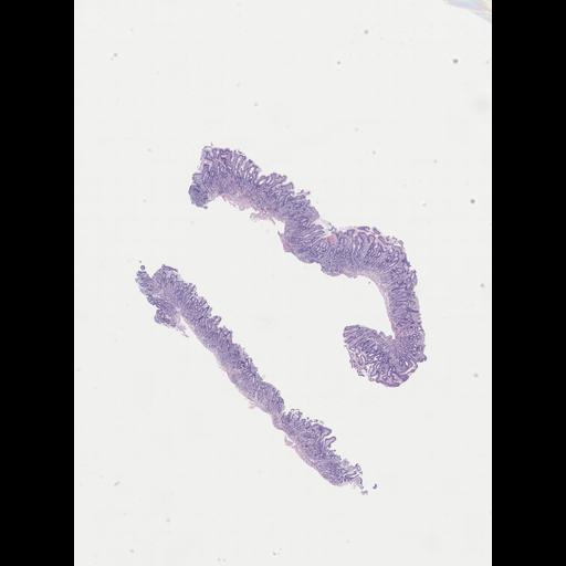  NCBI Organism:Homo sapiens, ; Biological process:;