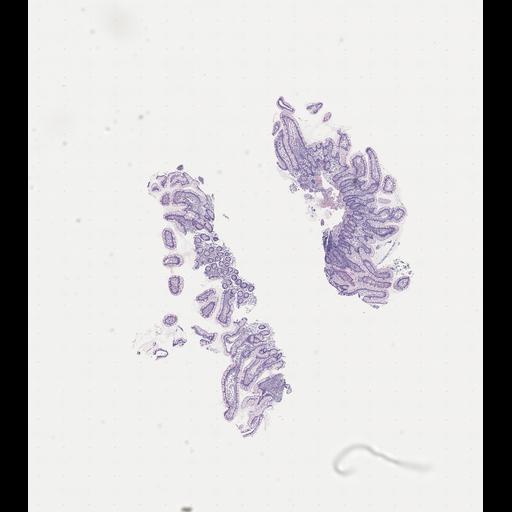  NCBI Organism:Homo sapiens, ; Biological process:;