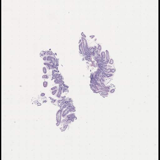  NCBI Organism:Homo sapiens, ; Biological process:;