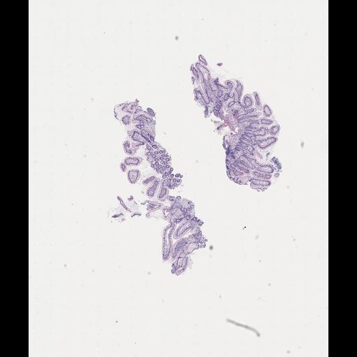  NCBI Organism:Homo sapiens, ; Biological process:;