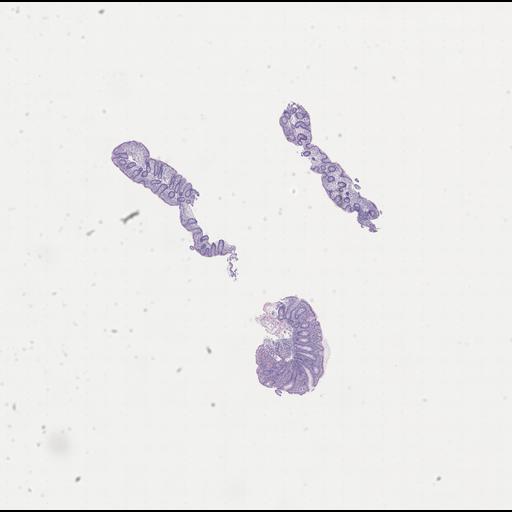  NCBI Organism:Homo sapiens, ; Biological process:;