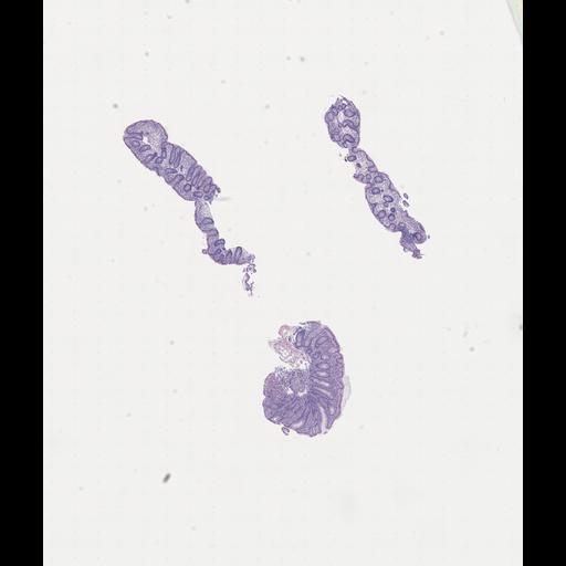  NCBI Organism:Homo sapiens, ; Biological process:;