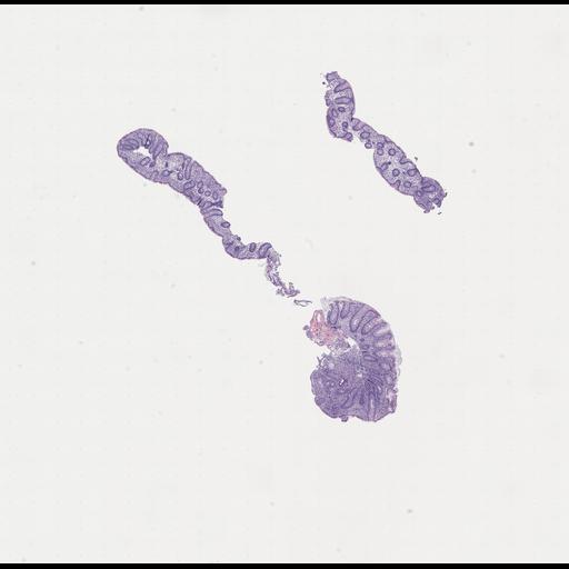  NCBI Organism:Homo sapiens, ; Biological process:;