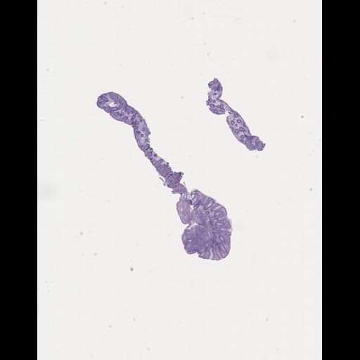  NCBI Organism:Homo sapiens, ; Biological process:;