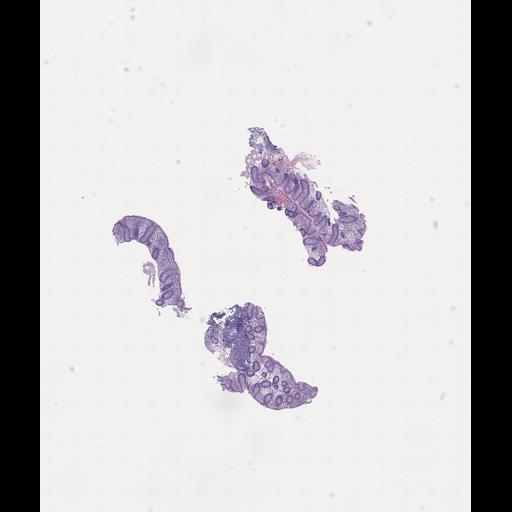  NCBI Organism:Homo sapiens, ; Biological process:;