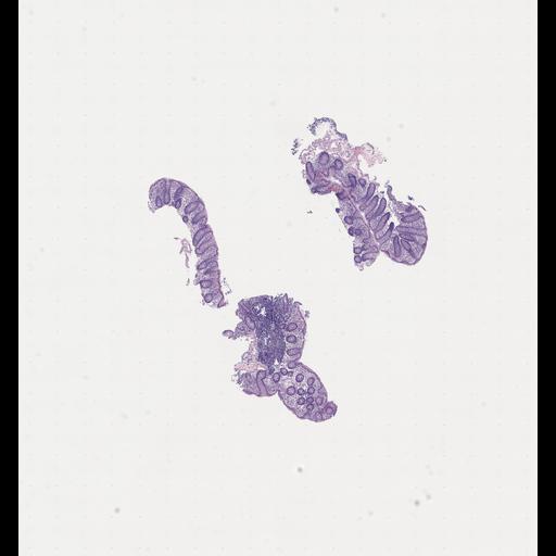  NCBI Organism:Homo sapiens, ; Biological process:;