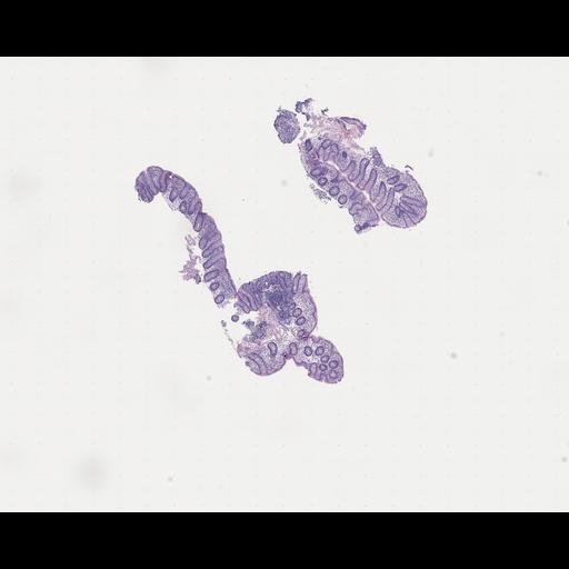  NCBI Organism:Homo sapiens, ; Biological process:;