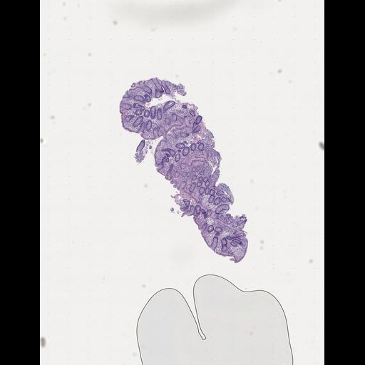  NCBI Organism:Homo sapiens, ; Biological process:;