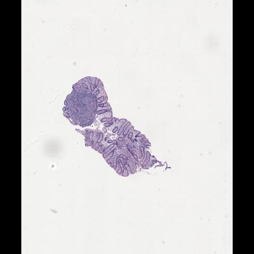  NCBI Organism:Homo sapiens, ; Biological process:;