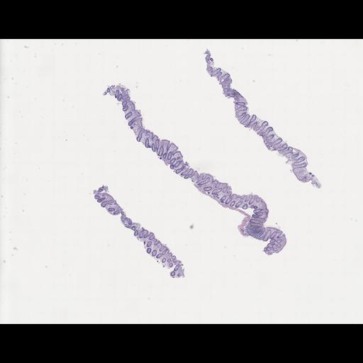  NCBI Organism:Homo sapiens, ; Biological process:;