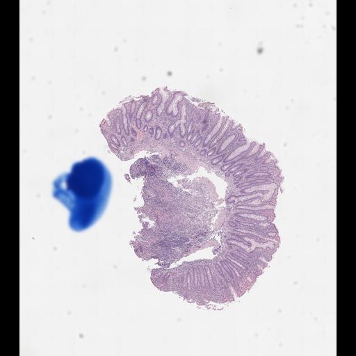  NCBI Organism:Homo sapiens, ; Biological process:;