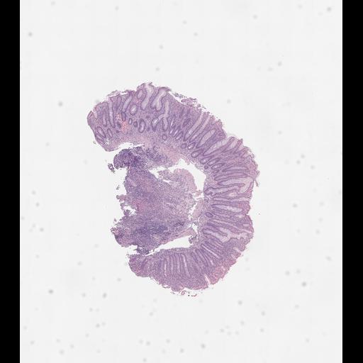  NCBI Organism:Homo sapiens, ; Biological process:;