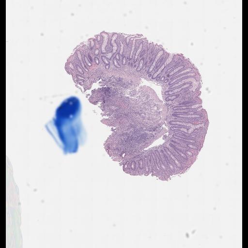  NCBI Organism:Homo sapiens, ; Biological process:;