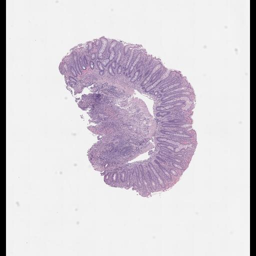  NCBI Organism:Homo sapiens, ; Biological process:;