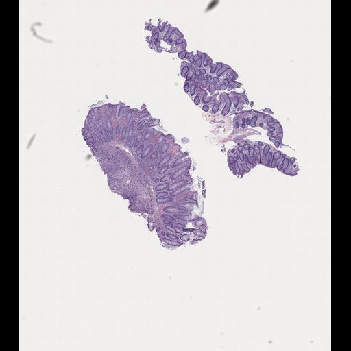  NCBI Organism:Homo sapiens, ; Biological process:;