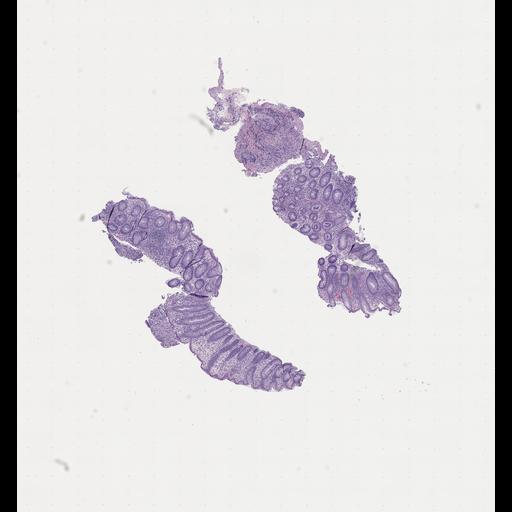  NCBI Organism:Homo sapiens, ; Biological process:;