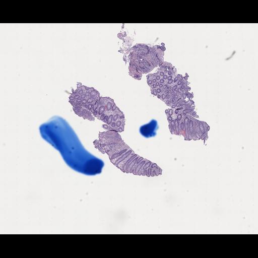  NCBI Organism:Homo sapiens, ; Biological process:;