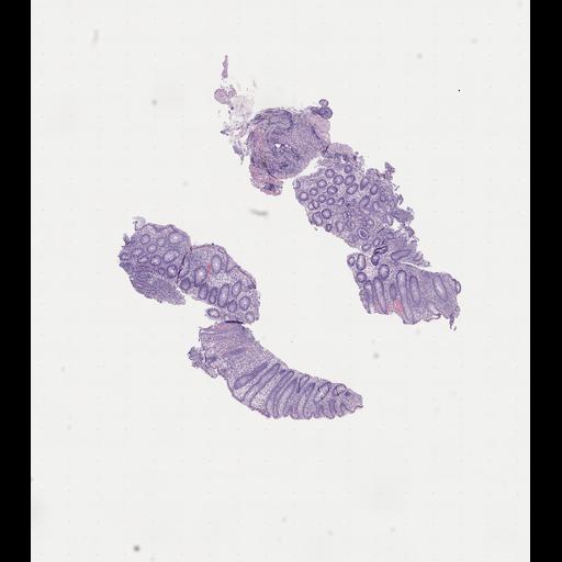  NCBI Organism:Homo sapiens, ; Biological process:;