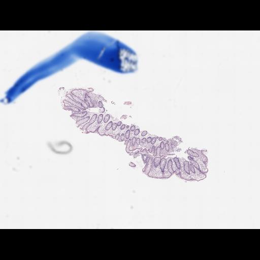  NCBI Organism:Homo sapiens, ; Biological process:;