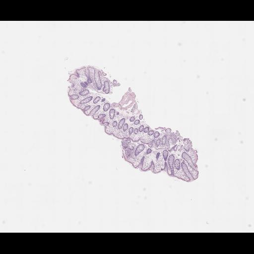  NCBI Organism:Homo sapiens, ; Biological process:;