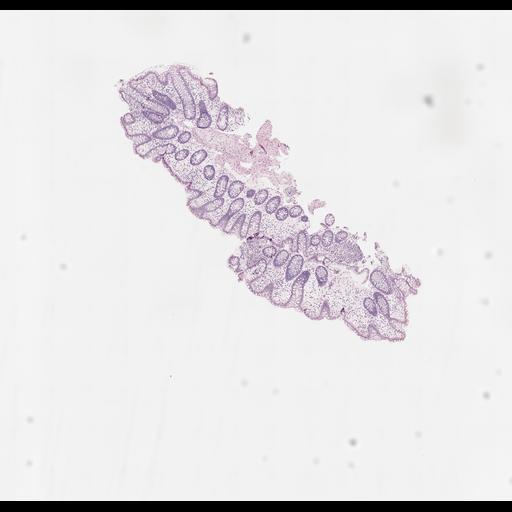  NCBI Organism:Homo sapiens, ; Biological process:;