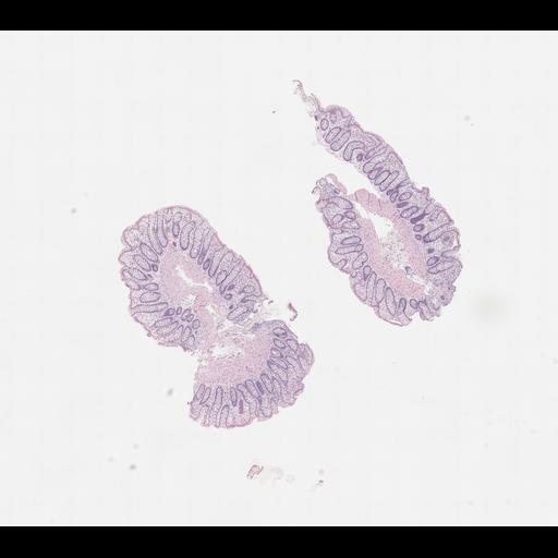  NCBI Organism:Homo sapiens, ; Biological process:;